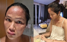 Chuyện gì xảy ra với H'Hen Niê sau khi xuất hiện với gương mặt khác lạ