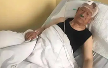 Ngày càng nhiều người tử vong vì đột quỵ não: 3 thói quen này dù có thích đến mấy cũng phải bỏ ngay