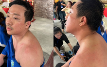 Chưa bao giờ thấy Trấn Thành tơi tả đến mức độ này