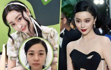 37 ca phẫu thuật, gần 30 tỷ đồng và cái kết cay đắng của người phụ nữ muốn trở thành Phạm Băng Băng thứ hai