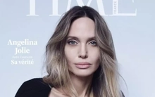 Angelina Jolie công khai vết sẹo cắt bỏ ngực