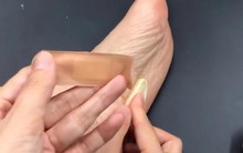 Người phụ nữ 56 tuổi dán tỏi vào lòng bàn chân suốt 6 tháng, kết quả khám sức khỏe khiến bác sĩ "ngã ngửa"