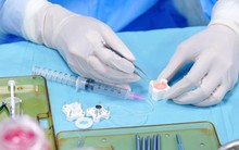 Sáng chế của nữ bác sĩ Việt tạo bước tiến mới trong ghép giác mạc