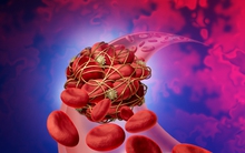 Cục máu đông rất "sợ" 1 loại củ quen mặt trong bếp Việt: Thường xuyên ăn giúp tránh xa đột quỵ, đau tim