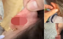 Xác minh vụ giáo viên tiểu học véo tai học sinh lớp 1 chảy máu ở Phú Quốc