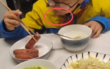 Bức ảnh ăn sáng khiến cư dân mạng tranh cãi: Nhìn môi đứa trẻ đi bố mẹ ơi, đang có vấn đề kìa!