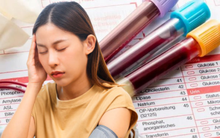 Sau những trường hợp ĐỘT TỬ hay ĐỘT QUỴ: BS nói đây là những gì người đang chơi thể thao cần làm để bảo vệ mình