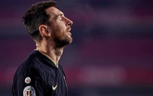 Messi thua lỗ