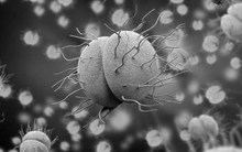 Xác định nguyên nhân tử vong của quân nhân thuộc Quân khu 1