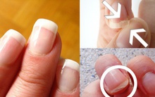 Muốn biết mình đang già đi nhanh hay chậm, hãy nhìn vào 1 đặc điểm này của móng tay