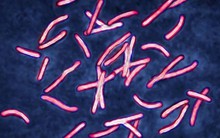 Mất cả thập kỷ các nhà khoa học mới hiểu vì sao siêu vi khuẩn kháng kháng sinh, còn AI của Google chỉ cần 2 ngày