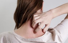 Khảo sát 8.400 người 50-60 tuổi: hơn 50% nghĩ bản thân trẻ hơn tuổi, xem nhẹ nguy cơ mắc căn bệnh "đau hơn đau đẻ"