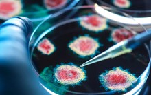 Virus nguy hiểm xuất hiện tại Mỹ: Người Việt có cần lo lắng?