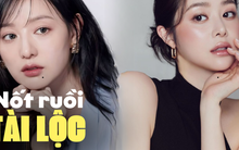 3 vị trí nốt ruồi dự báo may mắn, tài lộc dồi dào, có "của ăn của để" khi bước vào tuổi trung niên