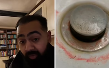 Bác sĩ đưa ra CẢNH BÁO ĐÁNG SỢ cho bất kỳ ai tìm thấy 'chất nhờn màu hồng' trong phòng tắm của mình