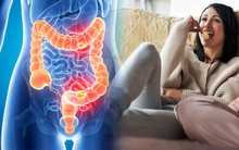 Ngày càng nhiều người trẻ tử vong do 'căn bệnh ung thư của người già': Chuyên gia cảnh báo khẩn