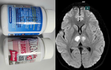 Hà Nội: Cô gái 21 tuổi bất tỉnh, tổn thương não nặng vì dùng thuốc “7 ngày giảm 7kg” mua trên Tiktok