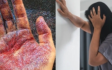 Hạt vi nhựa cao gấp 150 lần ở người đột quỵ so với người khỏe mạnh: Có 6 mẹo hay giảm hấp thụ