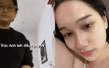 Trúc Anh (Mắt Biếc) công khai hình ảnh lạ lúc tăng cân: Không thể đi nhanh, khóc vì thay đổi gây sốc của cơ thể