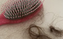 Nguy cơ tóc rụng lả tả vì nắng: 6 dấu hiệu không thể bỏ qua!