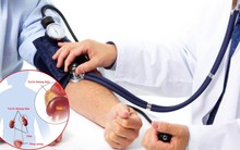 Người đàn ông 34 tuổi đi khám, phát hiện huyết áp cao vút: "Thủ phạm" bất ngờ ở trong ổ bụng