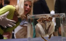 Ngày định mệnh của y học hiện đại: Ca cấy ghép tim nhân tạo đầu tiên trên thế giới và hành trình vượt qua giới hạn sự sống