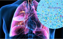 22 triệu hạt vi nhựa 'chui' vào cơ thể người bằng cách không ngờ tới: Làm ngay 7 điều để giảm nguy cơ