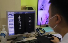 Máy xạ trị chạy 23 tiếng mỗi ngày vì quá tải bệnh nhân ung thư