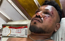 "Khi tỉnh lại, xung quanh tôi toàn xác chết": Lời kể ám ảnh của hành khách ngồi ghế 11A sau thảm hoạ hàng không khiến hàng trăm người thiệt mạng