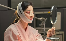 Mỹ nhân Giày Thủy Tinh gây sốc với gương mặt sưng tấy đáng sợ, băng bó kín mít