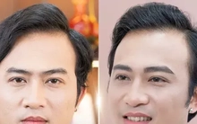 Cả showbiz Việt đi phun chân mày phong thủy cải vận?