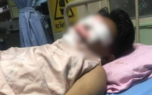 Thiết bị điện phát nổ khiến 3 người bị thương, cảnh sát điều tra phát hiện những dấu hiệu đáng ngờ