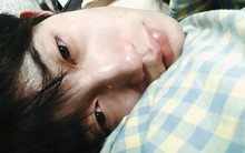 Soi làn da ra ngay bệnh gan: Thấy 3 kiểu “đỏ, đen, vàng” này đi khám nhanh còn kịp!