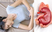 Cô gái trẻ 18 tuổi đã bị hỏng thận vì 3 kiểu ăn uống thường gặp ở người trẻ: BS khuyên làm ngay 4 việc để để bảo vệ "nhà máy lọc máu" của cơ thể