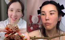 Mặt nữ mukbang biến dạng nghiêm trọng sau 2 năm hành nghề