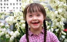 Kỳ tích y khoa Nhật Bản: Chỉnh sửa gen, loại bỏ thành công nhiễm sắc thể gây hội chứng Down