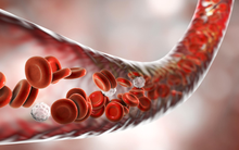 Ba thói quen “phá mạch máu” nhanh hơn ăn thịt mỡ: Nhiều người vẫn vô tư làm mỗi dịp hè