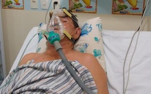 Ăn hải sản kiểu này, người đàn ông suýt chết vì suy gan cấp, bác sĩ thở dài: Bổ chưa thấy, toàn thấy ĐỘC