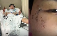 Nằm mơ mình bị rượt đuổi, thanh niên lao từ cửa sổ tầng 3 xuống đất mà không hề hay biết