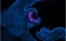 Loài vật có thể "mọc lại" cả nhãn cầu: Phát hiện mới mở kỳ vọng cho y học tái tạo của con người