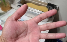 Dù giữa mùa hè, đổ mồ hôi nhiều ở 4 bộ phận này thì... trong người đầy bệnh!