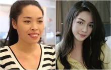 10 năm sau ca phẫu thuật "thay đầu" thành công nhất Việt Nam: Nữ chính được trao thân phận khác nhưng có 1 điều gây tiếc nuối