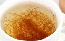 Thức khuya có hại gan không?