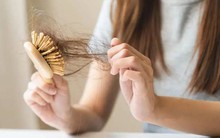Tóc rụng lả tả chưa chắc là do thiếu chất, 4 thói quen vô tình này khiến tóc của bạn rụng nhiều hơn, điều thứ 3 lắm người mắc nhất