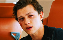 Sao nam đình đám bị chấn động não, “bom tấn” 5.300 tỷ đồng phải tạm dừng