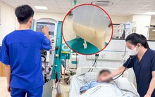 Người đàn ông có mỡ máu cao gấp 80 lần bình thường: Mỗi ngày đều uống một thứ nhiều người mê