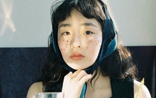 4 bất thường trên da là dấu hiệu của ung thư nhưng rất nhiều người KHÔNG HỀ HAY BIẾT!