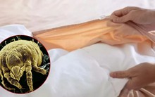 Vạch trần 2 ổ vi khuẩn rình rập ngay trên giường ngủ, bẩn đến mức không dám tin vào mắt mình!