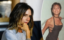Victoria Beckham đã phải chịu đựng căn bệnh này suốt 25 năm qua