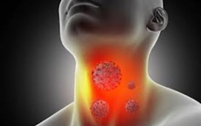 Cổ lên hạch tưởng bị viêm, người đàn ông bất ngờ phát hiện ung thư vòm họng giai đoạn 2: Các dấu hiệu hay bị xem thường